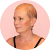 Cranial Prosthesis for Thinning Hair