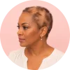 Cranial Prosthesis for Medical Hair Loss